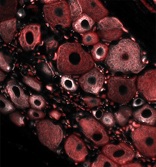 Immunofluorescence image of dorsal root ganglion (DRG) neurons