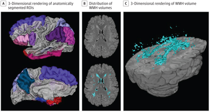 Figure 1. Neuroimaging Measures