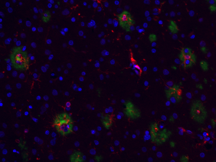 Photo of human microglia (red) in and around amyloid plaques (green) in the human cortex