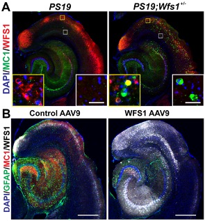 WFS1 deficiency is associated with increased tau pathology in PS19 tau mice