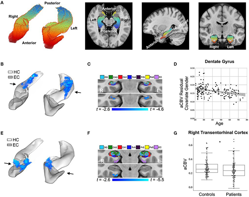 DeepContrast maps differential anatomical patterns of dysfunction in the hippocampal formation