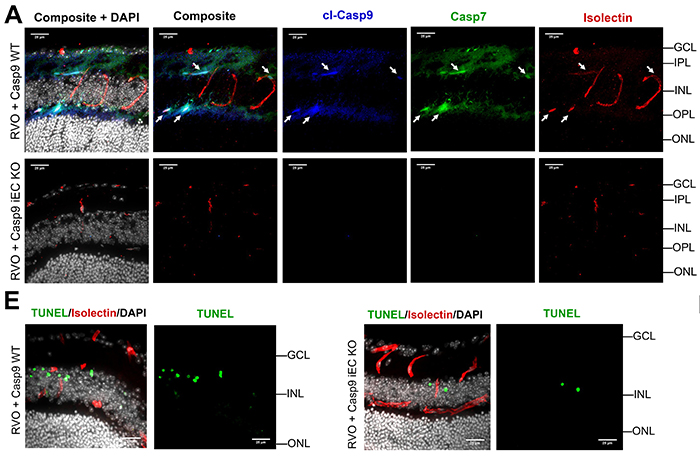 Figure 7: Endothelial caspase-9 mediates neuronal injury following RVO